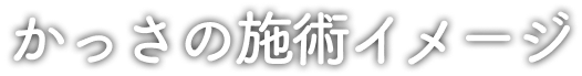かっさの施術イメージ